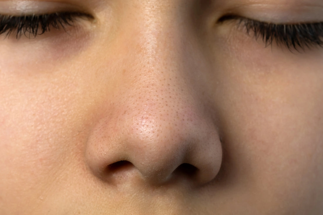 Pore Refining & Blackhead Removal Using Hydrodermabrasion