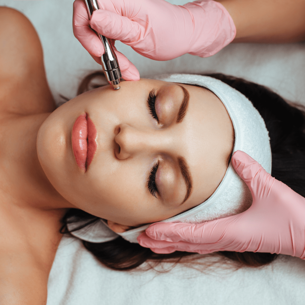 Microneedling Facial