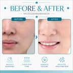 hydra facial machine