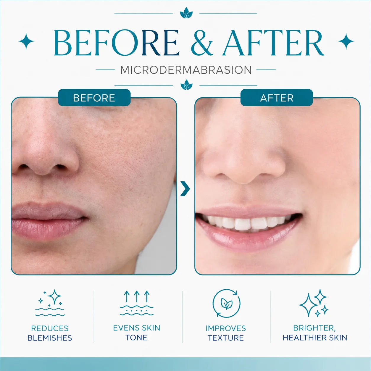 hydra facial machine