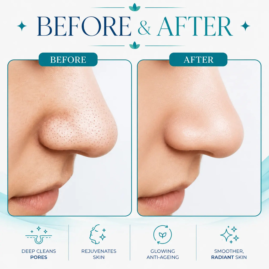 hydra facial machine