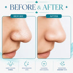 hydra facial machine