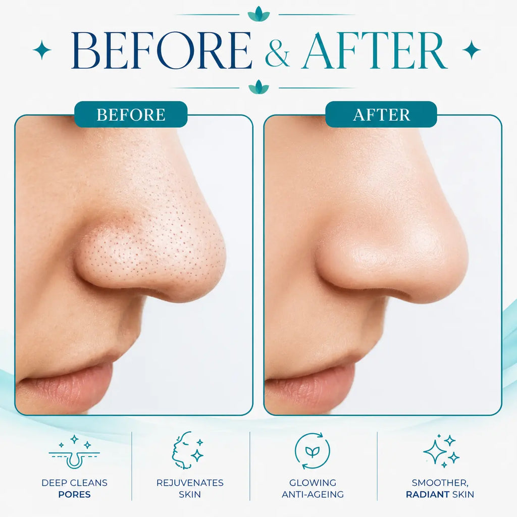 hydrafacial machines