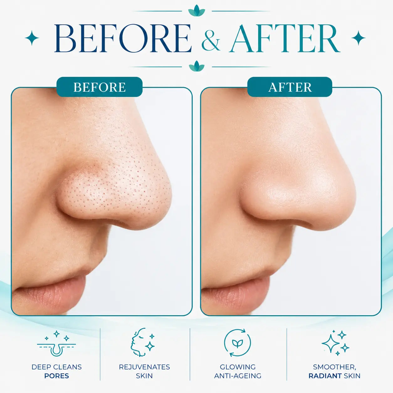 hydrafacial machines