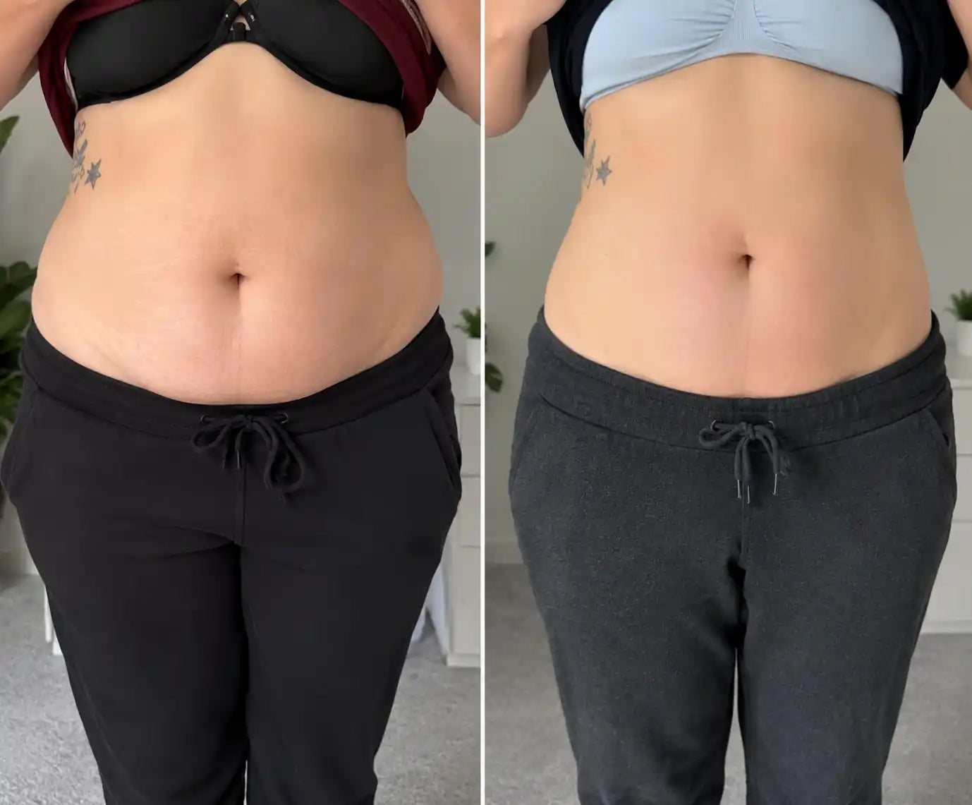 40k cavitation machine
