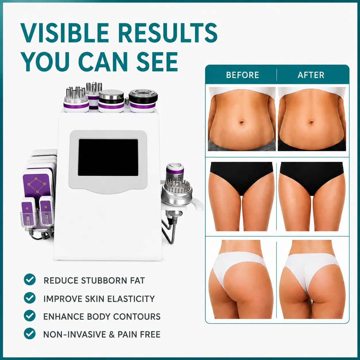 9 in 1 cavitation machine