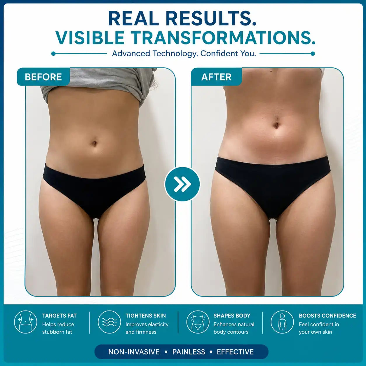 body cavitation machine
