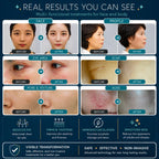 buy radio frequency skin tightening machine