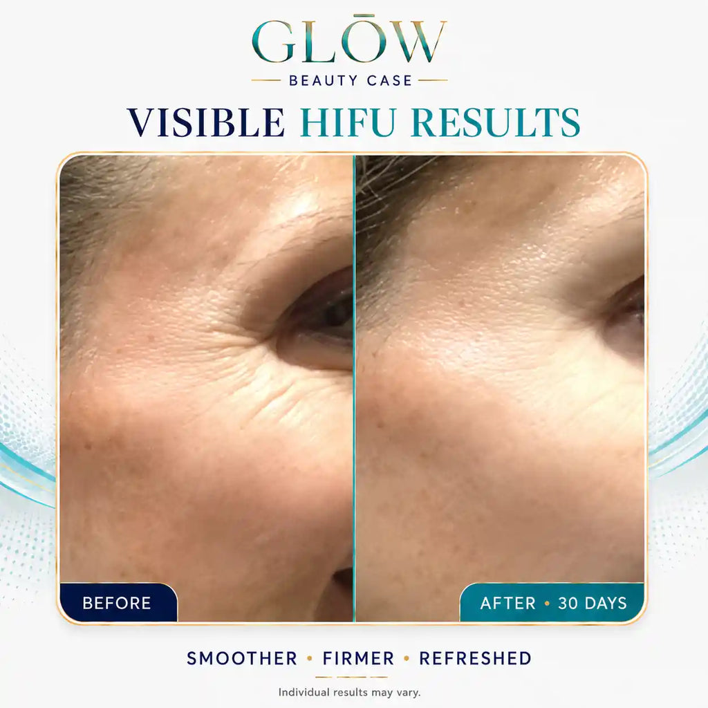 hifu reviews