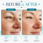 hydrafacial machines​