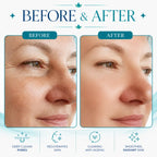 buy hydrafacial machine