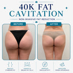 body sculpting machine​
