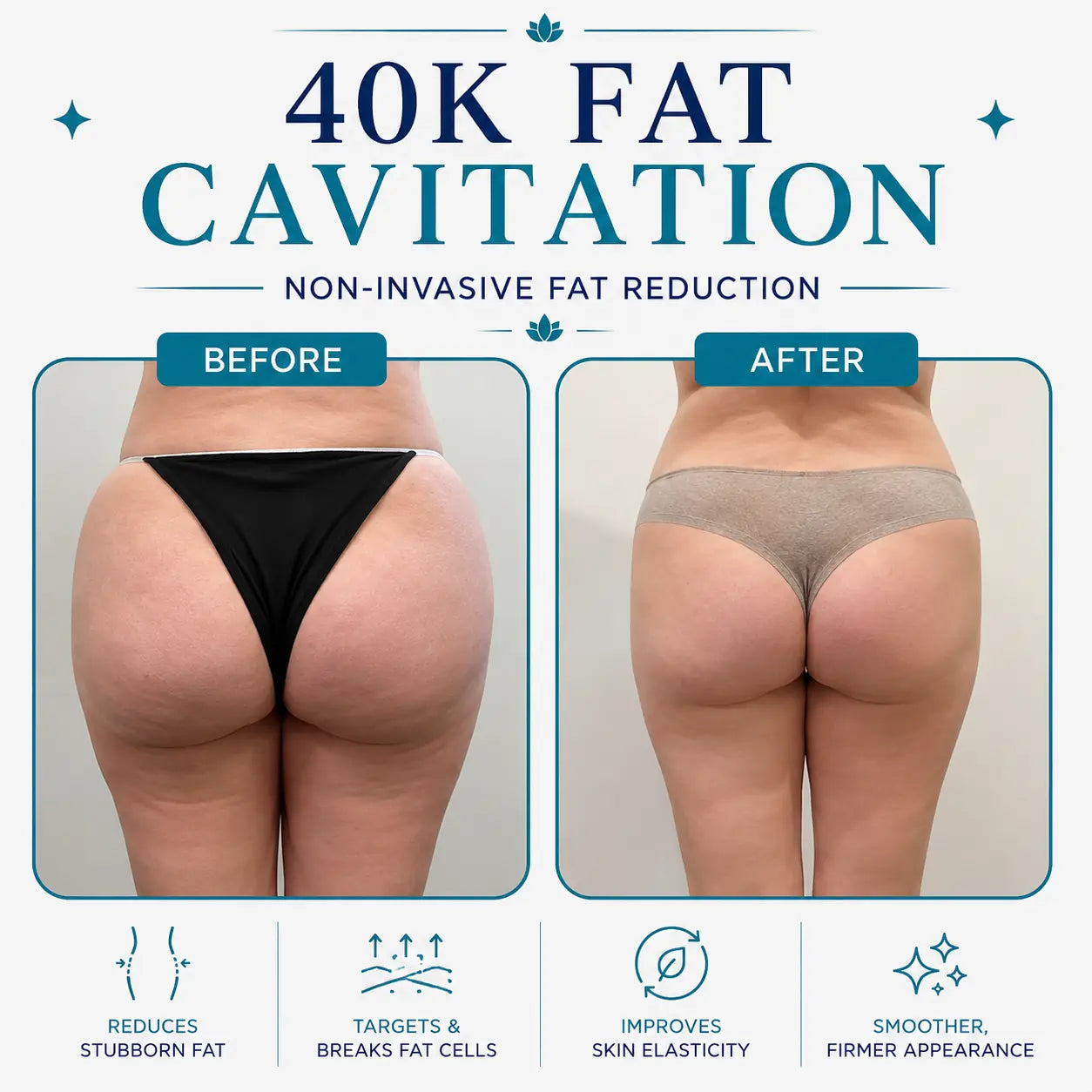 body sculpting machine​