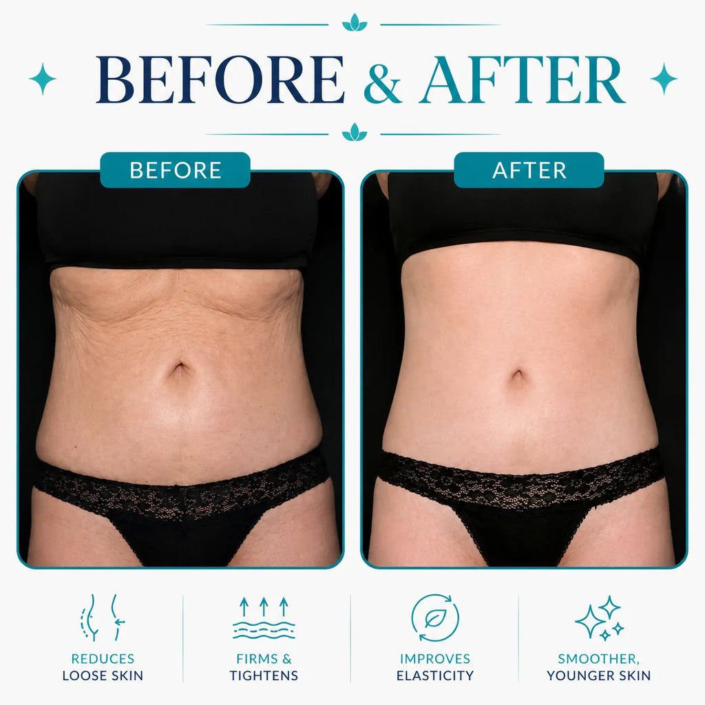 body contouring machine