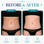 body contouring machine