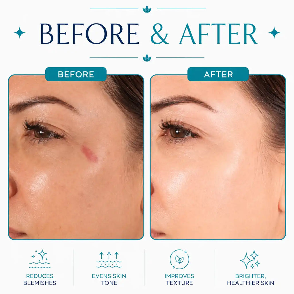 hydrafacial machine