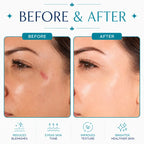hydrafacial machine