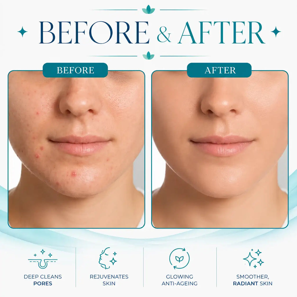 hydrafacial machine