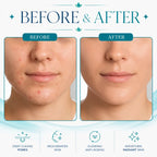 hydrafacial machine