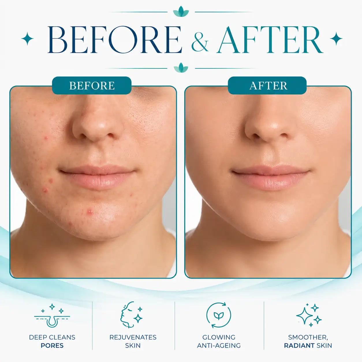 hydrafacial machine