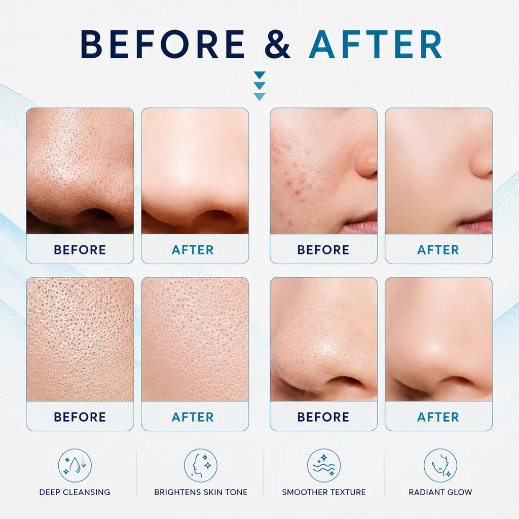 skin tightening machine