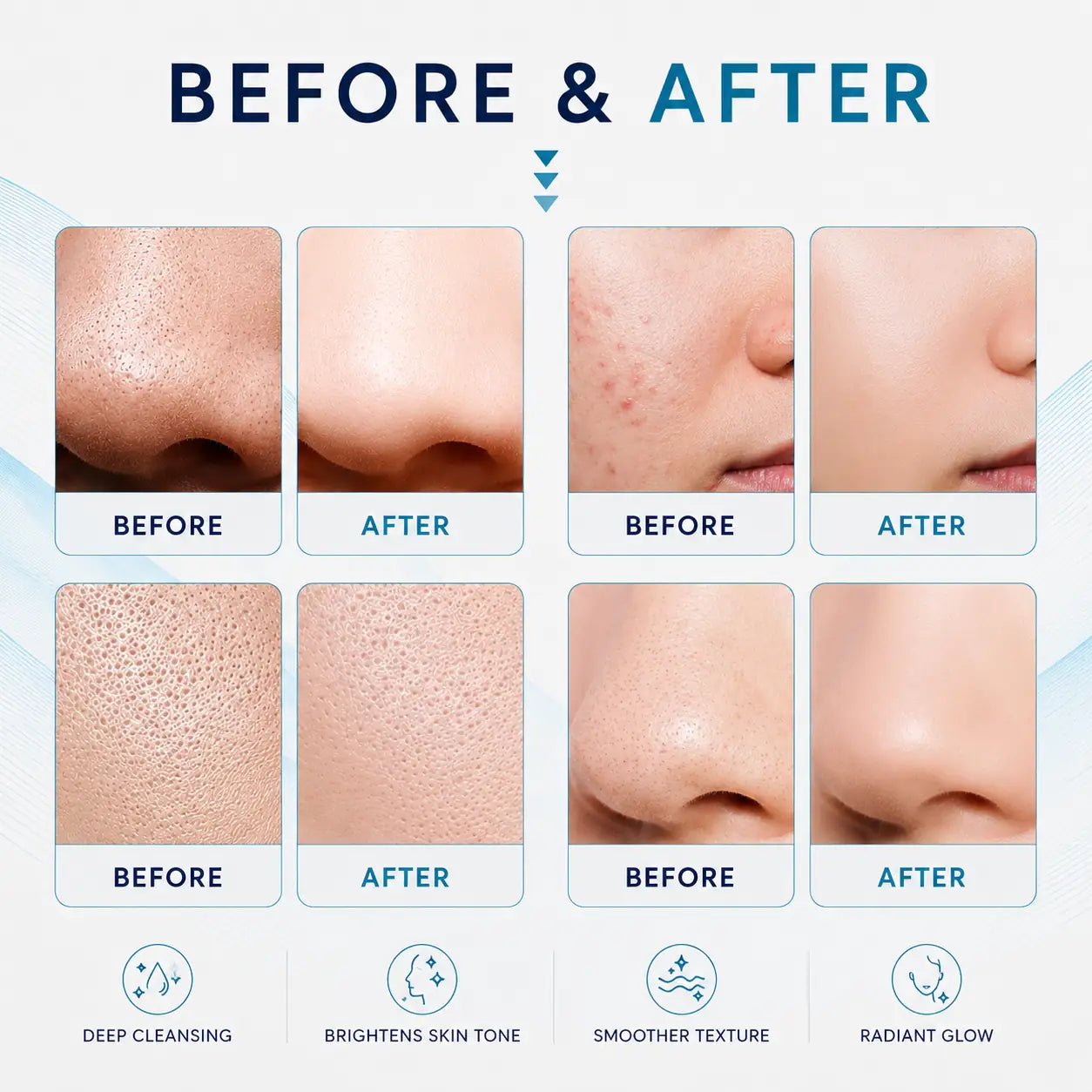 skin tightening machine