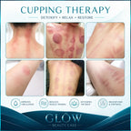 lipo cavitation machine