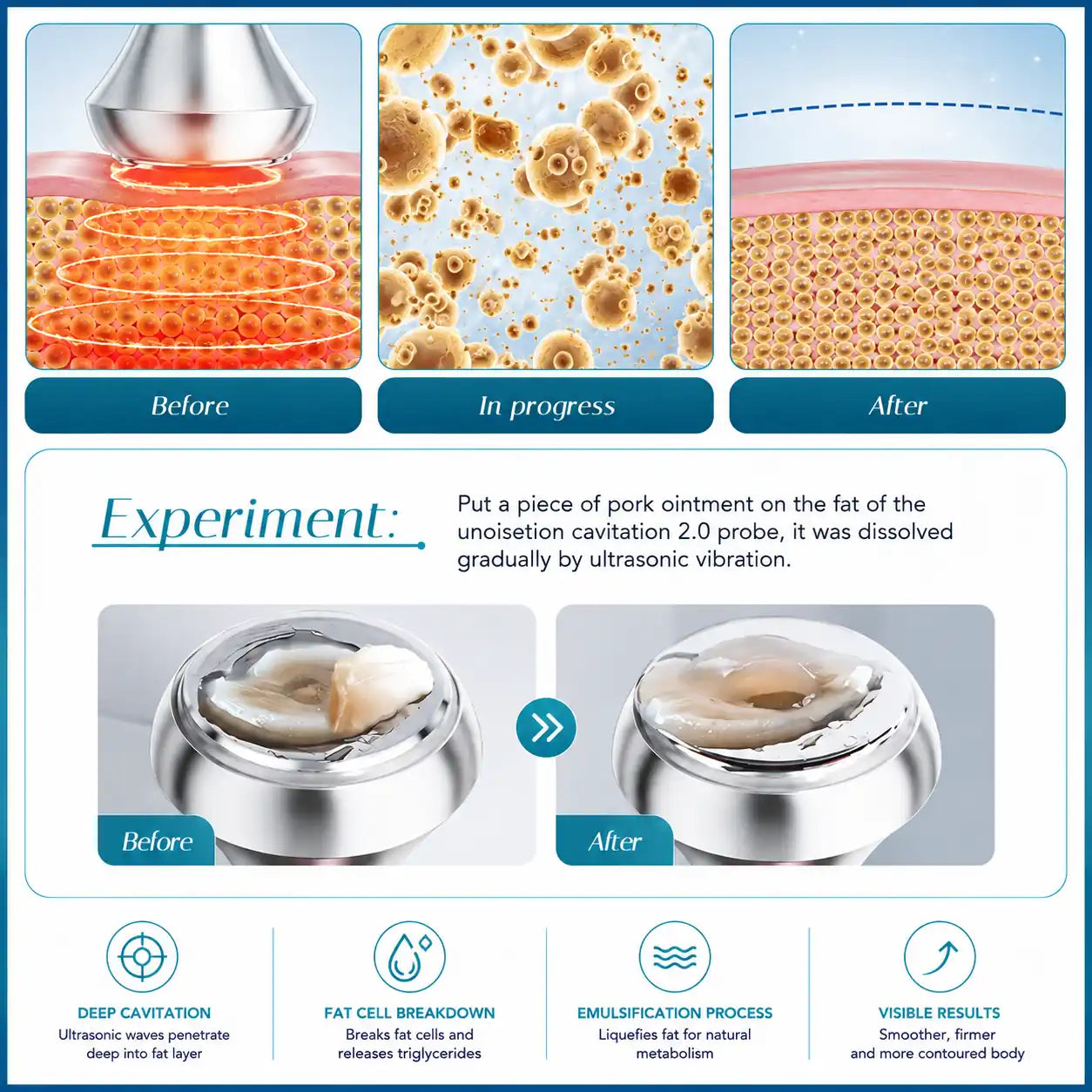 cavitation rf machine