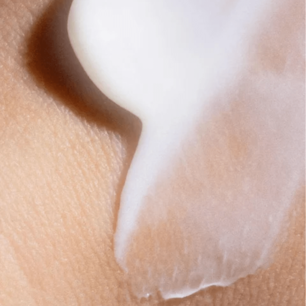 moisturiser for eczema-prone skin