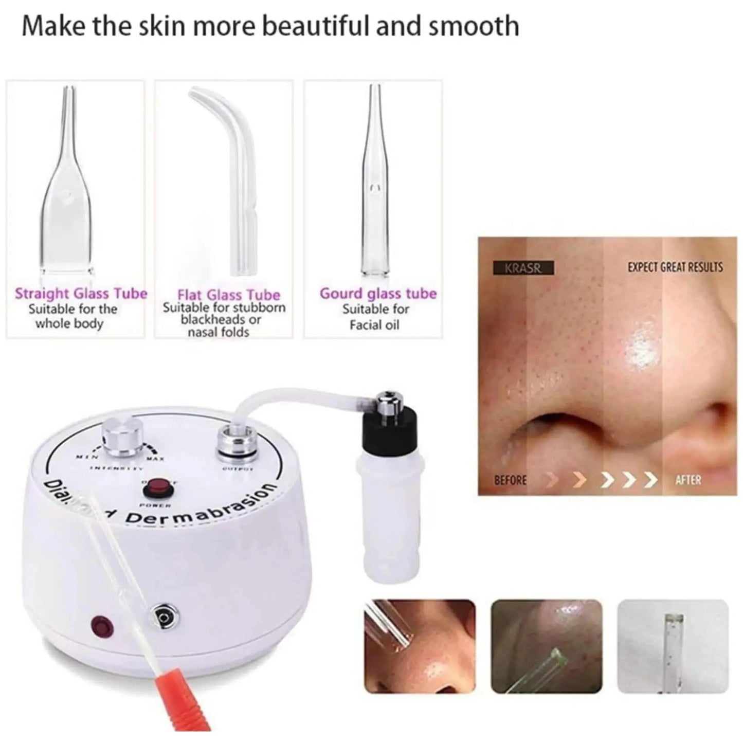 Diamond Microdermabrasion 3 in 1 Dermabrasion Machine uk