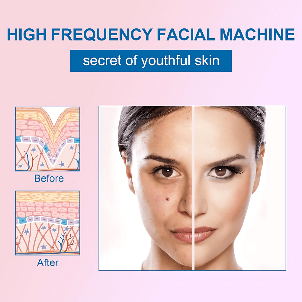 high frequency facial machine