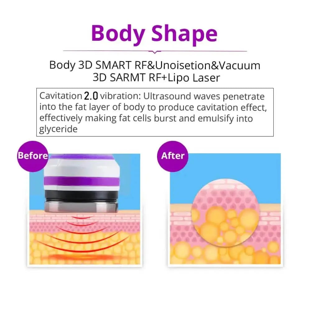 Professional Skin Lift Radio Frequency Massager