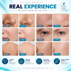 Superfacial Machine