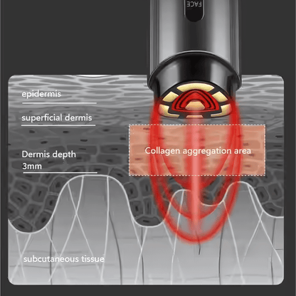 AMIRO R3 Turbo Facial RF Skin Tightening Device