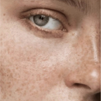 hyperpigmentation serum for face