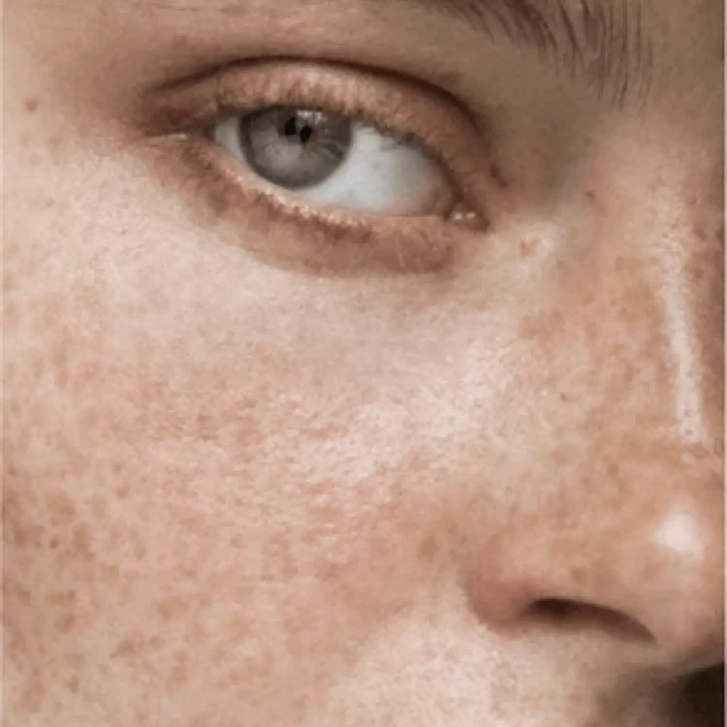 hyperpigmentation serum for face