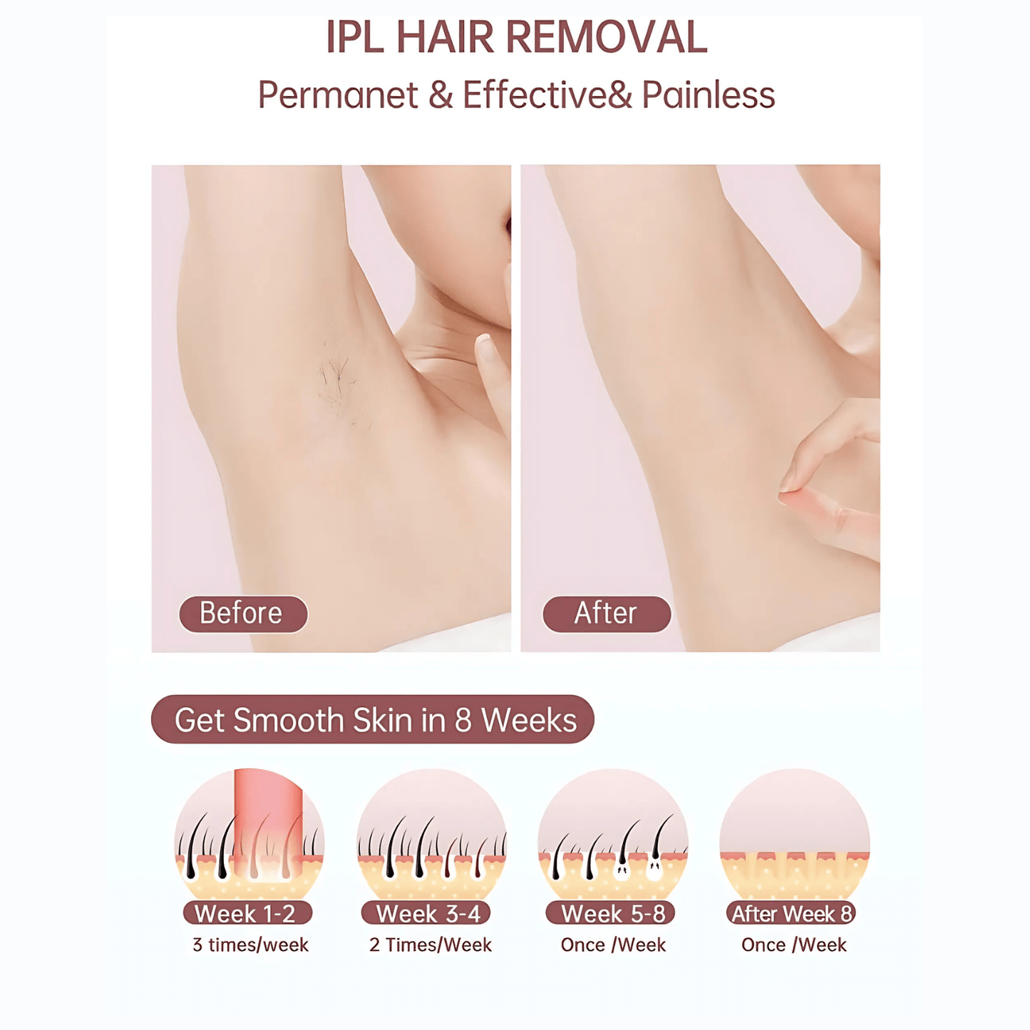 best laser hair removal clinic