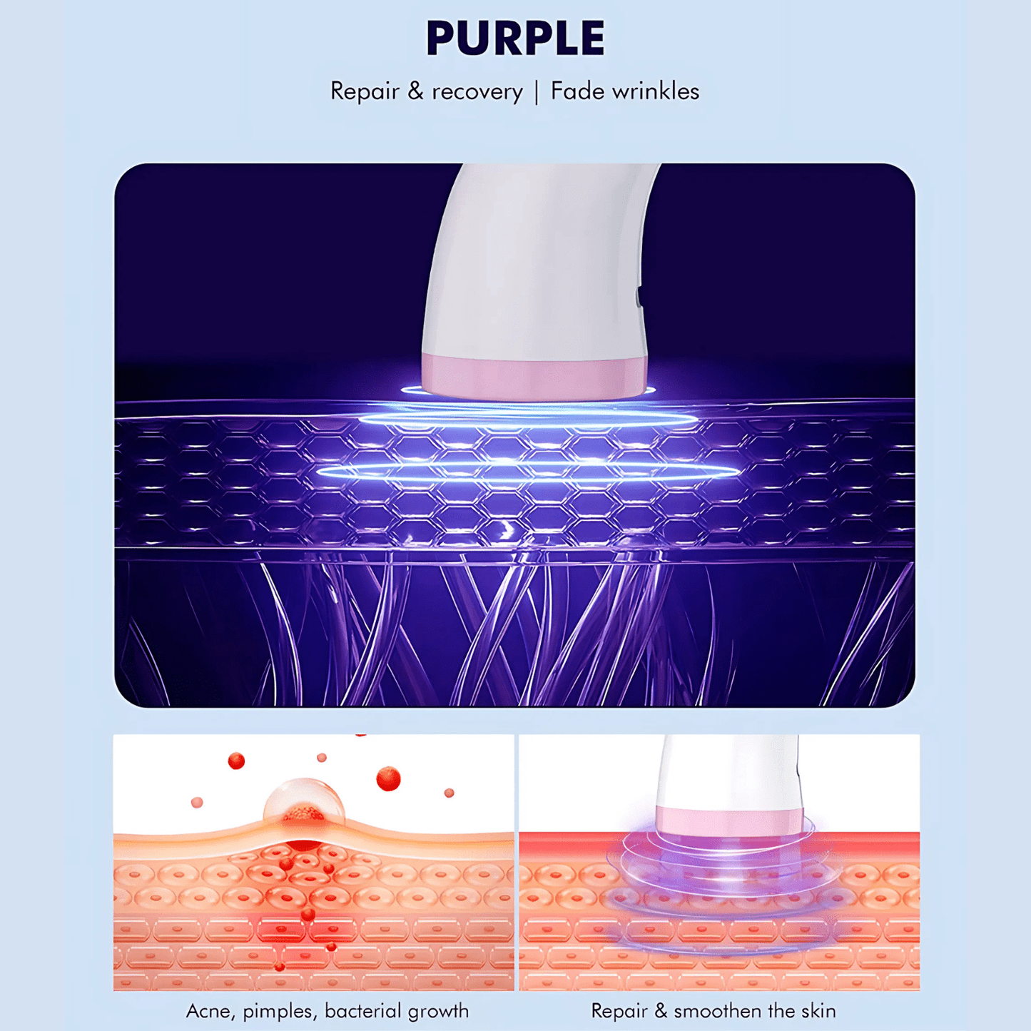 at home light therapy for acne