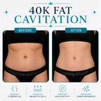 40K Cavitation 7 in 1 Body Sculpting Machine