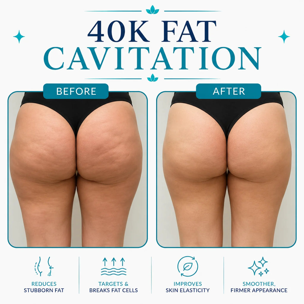 rf skin tightening machine​