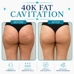 rf skin tightening machine​