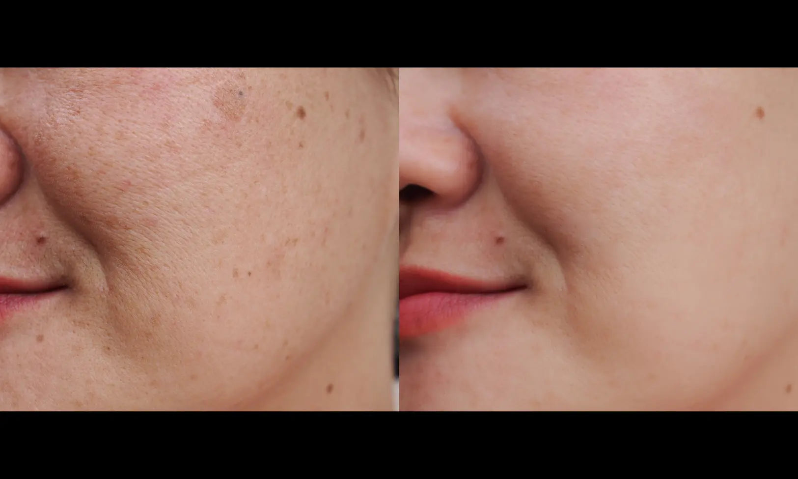 best eye wrinkle cream uk