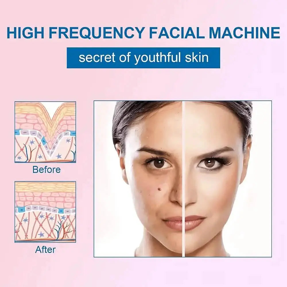 best high frequency wand​