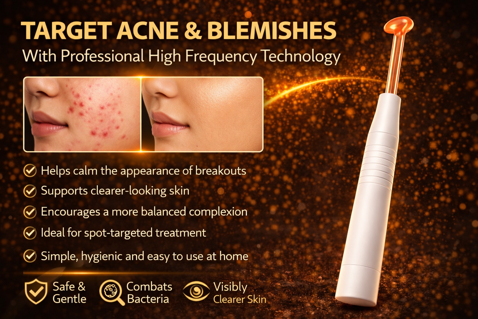 best skin care treatment for acne
