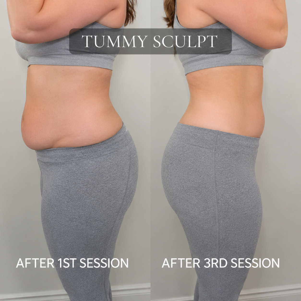 body sculpting machine professional