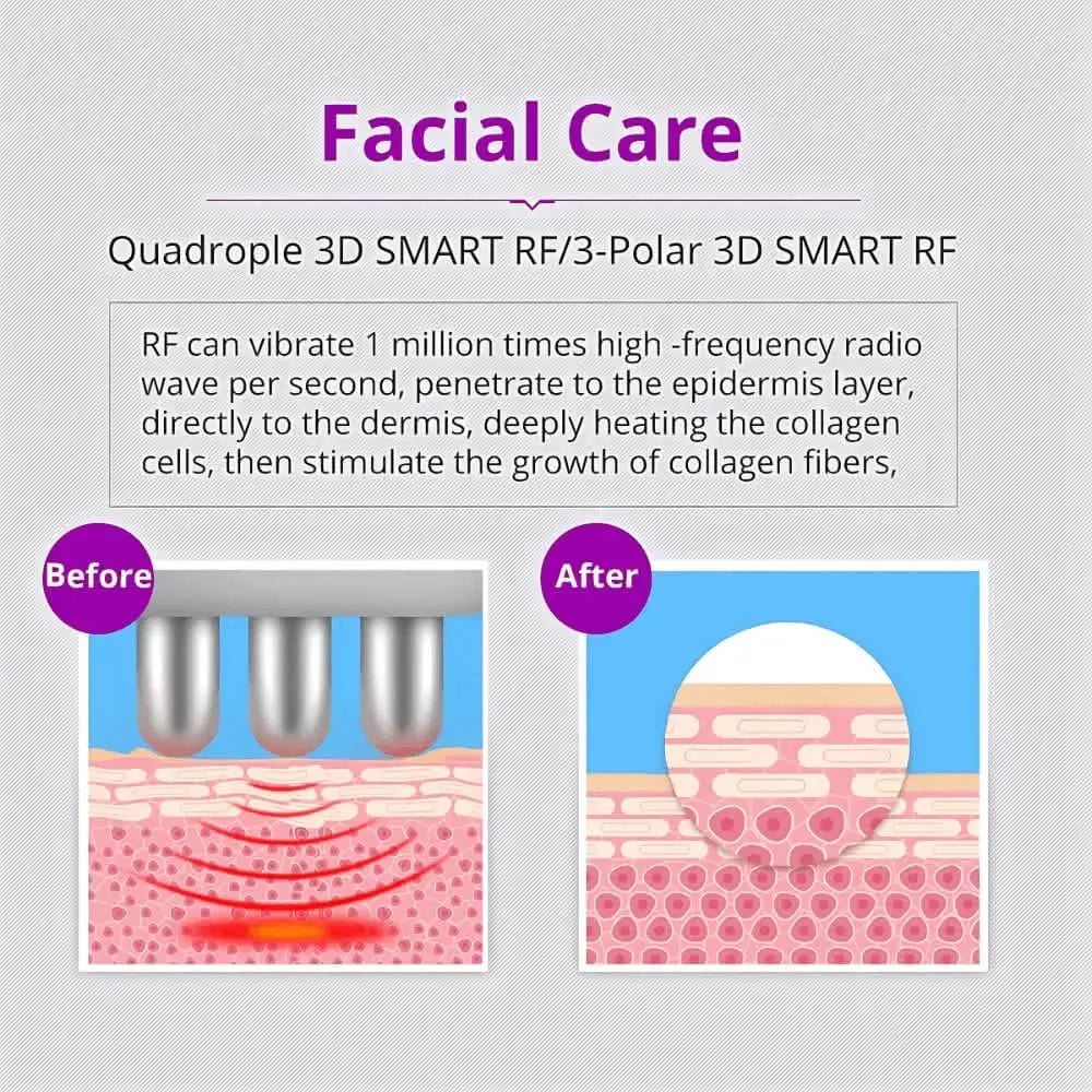 What Is a Cavi Machine? Your Complete Guide to Cavitation Technology ...