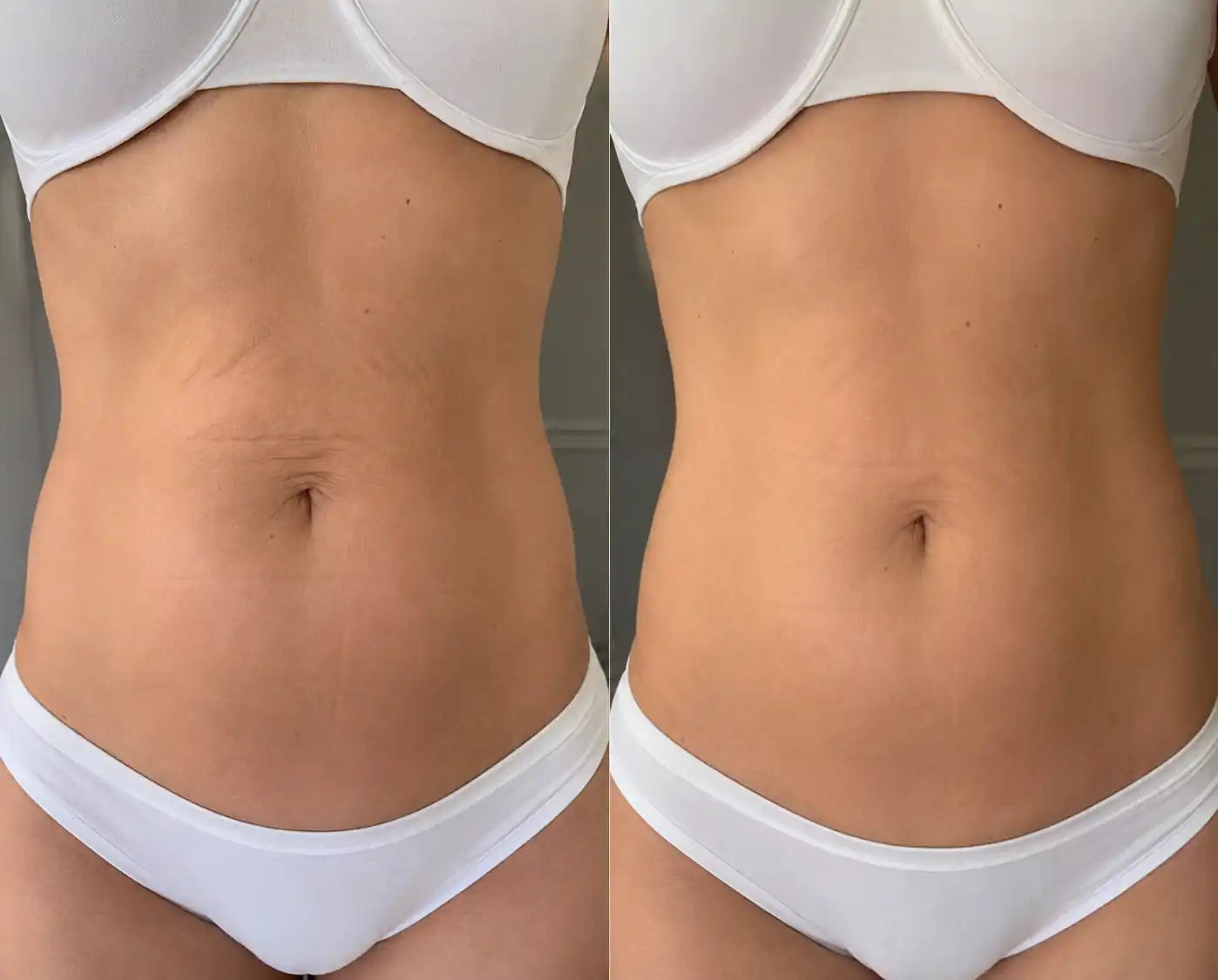 body sculpting machine professional