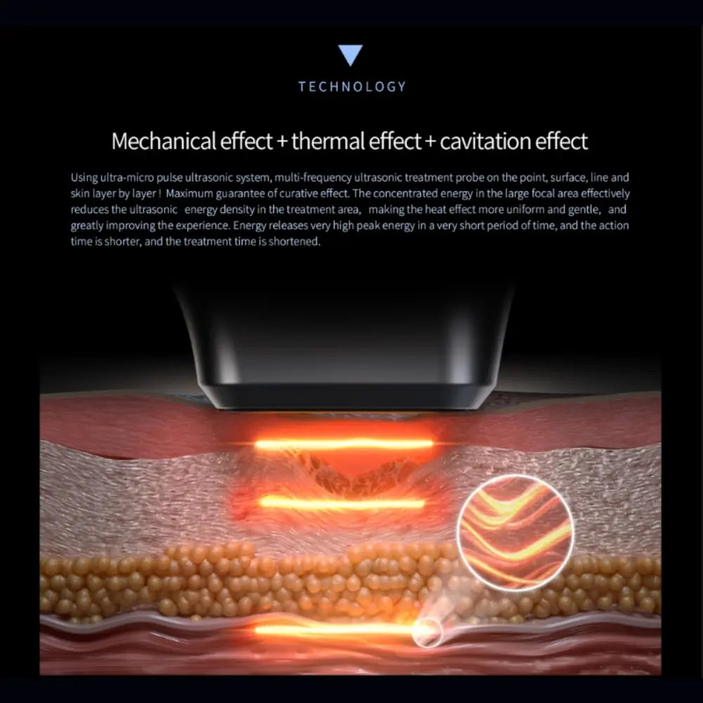 buy hifu machine for sale