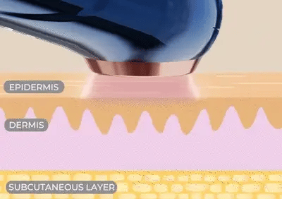 buy skin tightening machine