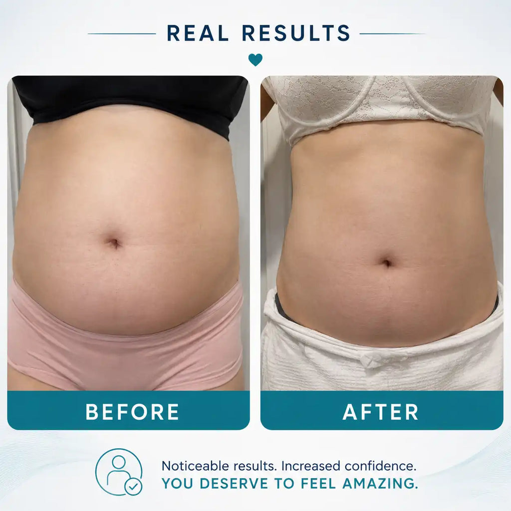 body sculpting machine​